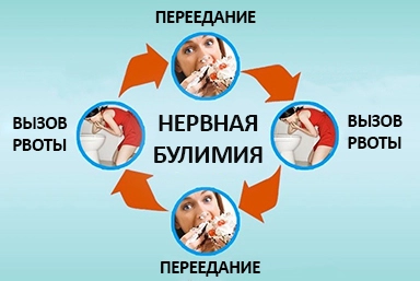 Лечение булимии в Эртиле